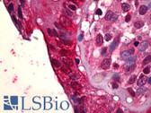 Anti-PLK1 / PLK-1 Antibody IHC-plus LS-B6646