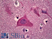 Anti-CAMKV Antibody (aa211-260) IHC-plus LS-B6648