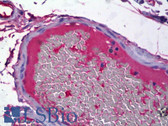 Anti-FGB Antibody (C-Terminus) IHC-plus LS-B6670