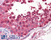 Anti-CSE1L Antibody (clone 2F4) IHC-plus LS-B6674