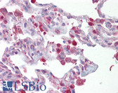 Anti-FRA-1 / FOSL1 Antibody (aa143-192) IHC-plus LS-B6677