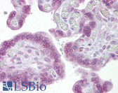 Anti-IRF6 Antibody (aa395-444) IHC-plus LS-B6678
