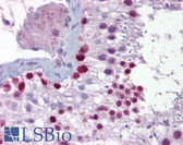 Anti-PITX3 Antibody (N-Terminus) IHC-plus LS-B6679