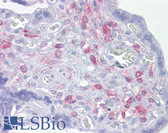 Anti-ING3 Antibody (aa216-265) IHC-plus LS-B6681