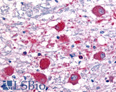 Anti-ROBO1 Antibody (aa1632-1644) IHC-plus LS-B81