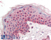 Anti-SFN / Stratifin / 14-3-3 Sigma Antibody (Internal) IHC-plus LS-B6688