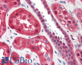 Anti-ALOX15 / 15-Lipoxygenase Antibody (Internal) IHC-plus LS-B6689