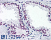 Anti-EZH2 Antibody IHC-plus LS-B6702