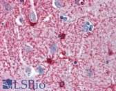 Anti-ENO1 / Alpha Enolase Antibody (aa246-295) IHC-plus LS-B6703