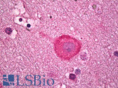 Anti-Serotonin Antibody IHC-plus LS-B6710