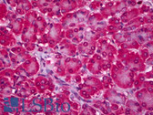 Anti-RTKN2 Antibody (clone 2C2) IHC-plus LS-B6720