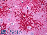 Anti-SLC1A2 / EAAT2 / GLT-1 Antibody (C-Terminus) IHC-plus LS-B6724