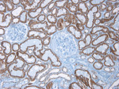 Anti-CDH6 / K Cadherin Antibody (clone 2B6) IHC-plus LS-B6726