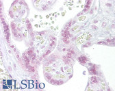 Anti-CHEK2 / CHK2 Antibody (N-Terminus) IHC-plus LS-B6730