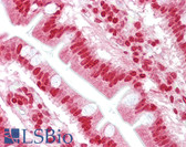 Anti-OAS1 Antibody (aa324-373) IHC-plus LS-B6731