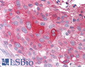 Anti-POU5F1 / OCT4 Antibody (aa100-200) IHC-plus LS-B85