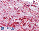 Anti-ATF1 Antibody (aa179-228) IHC-plus LS-B6733