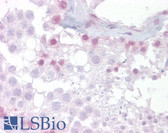 Anti-NR4A1 / NUR77 Antibody (N-Terminus) IHC-plus LS-B6735