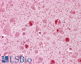 Anti-GSX2 / GSH2 Antibody (N-Terminus) IHC-plus LS-B6736