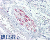 Anti-CACNA2D1 Antibody IHC-plus LS-B6739