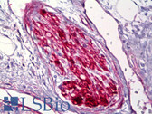 Anti-S100A1 / S100-A1 Antibody (Internal, clone EPR5251) IHC-plus LS-B6750