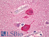 Anti-ENO2 / NSE Antibody (Internal, clone EPR3378) IHC-plus LS-B6752