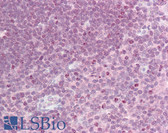 Anti-CRLF2 / TSLPR Antibody (clone 8H8) IHC-plus LS-B6755
