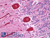 Anti-Alpha Tubulin Antibody (C-Terminus, clone YL1/2) IHC-plus LS-B6777