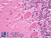 Anti-HES5 Antibody (Internal) IHC-plus LS-B6782