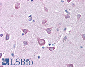 Anti-RPE65 Antibody IHC-plus LS-B90