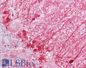 Anti-EP / DBI Antibody (N-Terminus) IHC-plus LS-B6783
