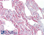 Anti-PTHLH / PTHRP Antibody (aa77-126) IHC-plus LS-B6787