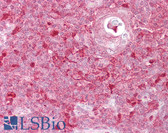 Anti-TIMELESS Antibody (aa290-339) IHC-plus LS-B6788