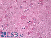 Anti-CXCR3 Antibody (aa161-210) IHC-plus LS-B6789