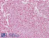 Anti-TDP-43 / TARDBP Antibody (aa252-301) IHC-plus LS-B6796