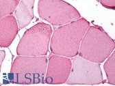Anti-CA3 / Carbonic Anhydrase III Antibody IHC-plus LS-B6798