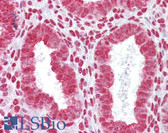 Anti-HOXA11 Antibody (aa210-259) IHC-plus LS-B6805