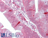 Anti-ATF4 Antibody (N-Terminus) IHC-plus LS-B6806