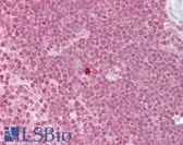 Anti-ZBTB7A / Pokemon Antibody (N-Terminus) IHC-plus LS-B6810