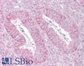 Anti-SUFU Antibody (C-Terminus) IHC-plus LS-B6811