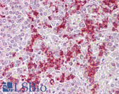 Anti-ZNF307 Antibody (aa38-87) IHC-plus LS-B6812