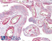 Anti-GRHL3 Antibody (aa431-480) IHC-plus LS-B6813