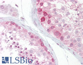 Anti-WNT2B Antibody (N-Terminus) IHC-plus LS-B6821