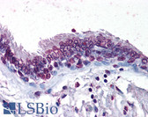 Anti-TERT / Telomerase Antibody (clone 2D8) IHC-plus LS-B95