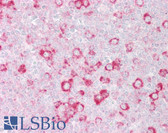 Anti-RHOD Antibody (C-Terminus) IHC-plus LS-B6828