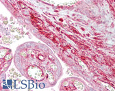 Anti-CALD1 / Caldesmon Antibody (aa578-627) IHC-plus LS-B6829