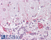 Anti-PSEN1 / Presenilin 1 Antibody (aa107-156) IHC-plus LS-B6832