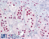 Anti-RORA / ROR Alpha Antibody (aa36-85) IHC-plus LS-B6839