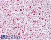 Anti-PSME3 Antibody (aa48-97) IHC-plus LS-B6840