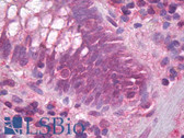 Anti-CD95 / FAS Antibody IHC-plus LS-B6851